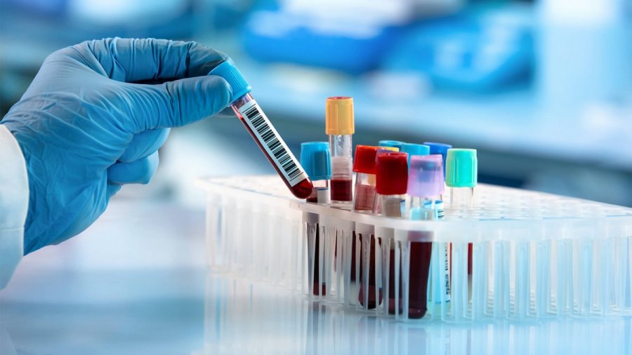Νέο τεστ αίματος ανιχνεύει 50 τύπους καρκίνου πριν την εμφάνιση ενδείξεων ή συμπτωμάτων