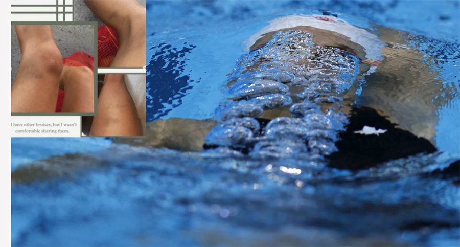 Σοκ στην παγκόσμια κολύμβηση: Καναδή Ολυμπιονίκης κατήγγειλε ότι βρέθηκε ναρκωμένη με μώλωπες