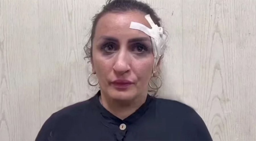 Αδιανόητο: Μητέρα πούλησε το νεογέννητό της για να κάνει… επέμβαση στη μύτη