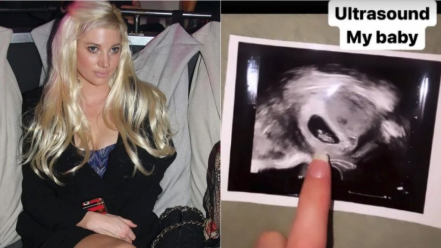 “Η εγκυμοσύνη δεν αντέχεται”: Η Τζούλια Αλεξανδράτου στην 1η φωτο με μαγιό μετά την ανακοίνωση για τον πελαργό