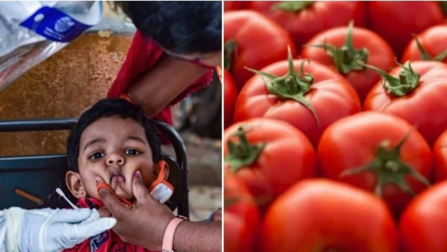 Συναγερμός στην Ινδία για τη γρίπη της ντομάτας -Η νέα λοίμωξη που εξαπλώνεται σε παιδιά