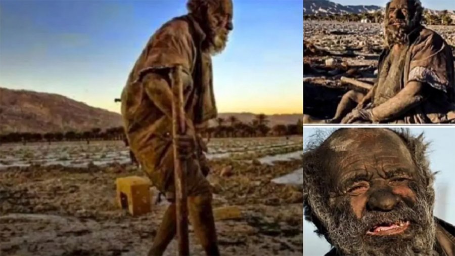 Πέθανε στα 94 «ο πιο βρόμικος άνθρωπος στον κόσμο» – Είχε να κάνει μπάνιο πάνω από 50 χρόνια [βίντεο]