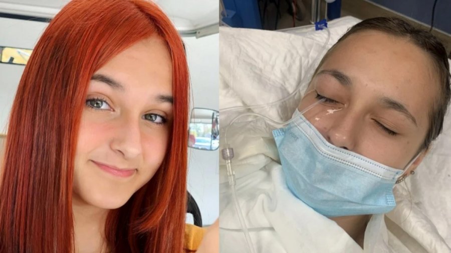 “Ελπίζουμε σε ένα θαύμα”: 13χρονη έχασε το ένα της μάτι από ένα λάθος που κάνουμε όλες με τις βαφές μαλλιών