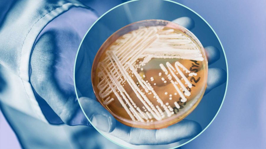 «Σούπερ μύκητας» ανθεκτικός στα φάρμακα βρέθηκε για πρώτη φορά σε πολιτεία των ΗΠΑ