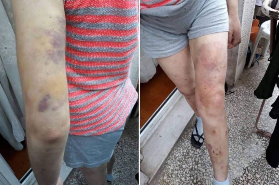 «Ήταν μόνιμα χτυπημένη σε όλο της το σώμα» – Νέα μαρτυρία για τον εφιάλτη της Φαίης στο διαμέρισμα της Κυψέλης