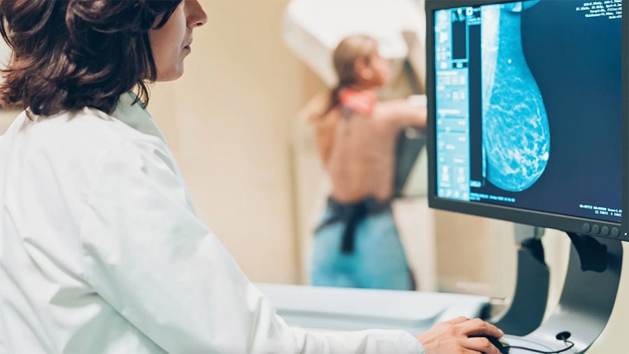 Τεχνητή Νοημοσύνη: Το βρετανικό ΕΣΥ με εργαλείο εντόπισε καρκίνο του μαστού που γιατροί είχαν αποτύχει να διαγνώσουν